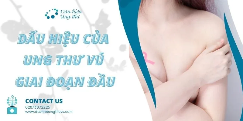 dấu hiệu của ung thư vú giai đoạn đầu