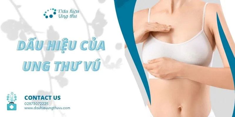 Dấu hiệu ung thư vú